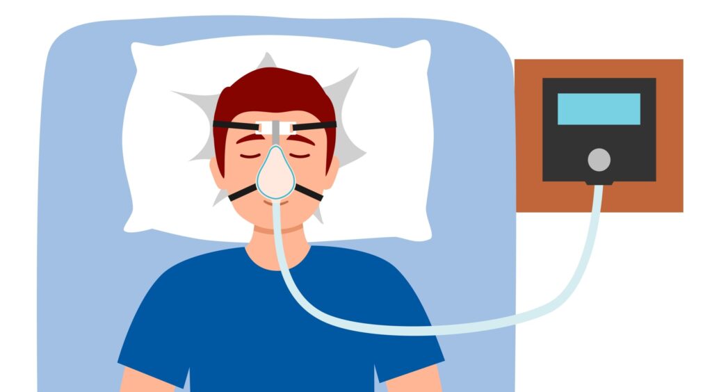 CPAP